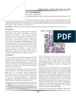 Infectious Mononucleosis: A Case Report