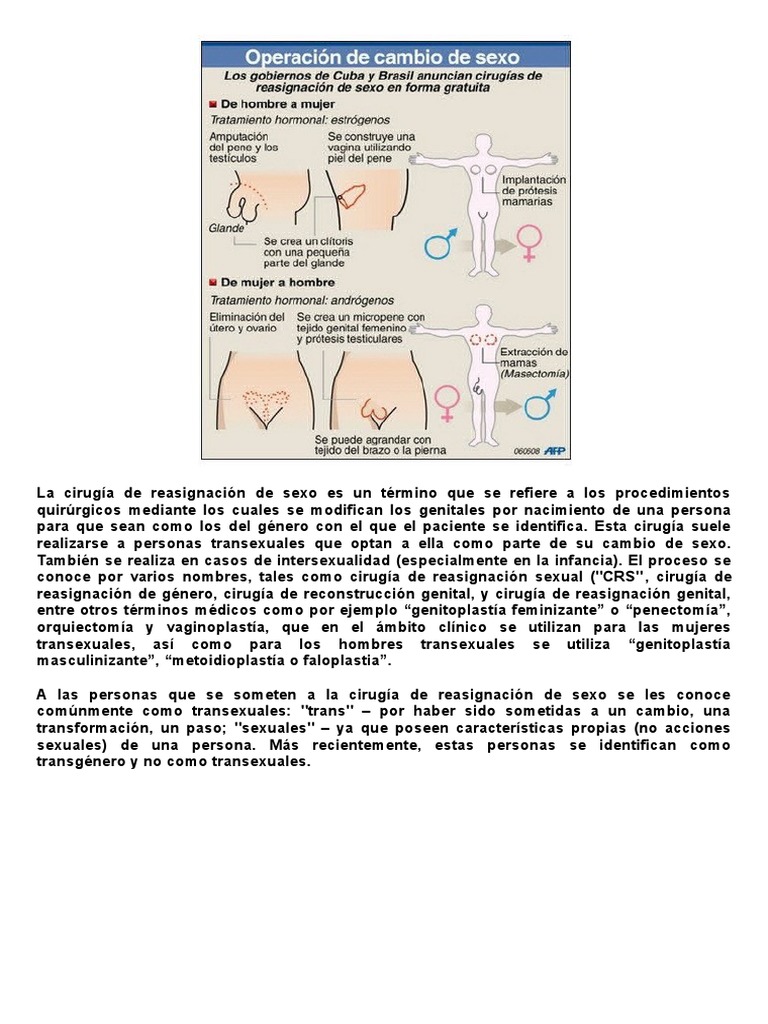 Operacion Cambio de Genero | PDF