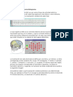 Cómo Leer El Electroencefalograma