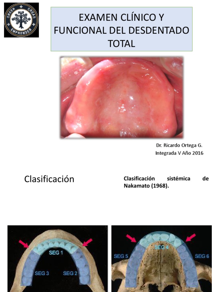 Clasificaciones de Rebordes. Protesis Total. | PDF