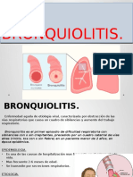 BRONQUIOLITIS