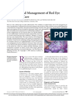 Conjunctivitis Diagnosis and Management