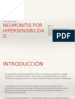 Neumonitis Por Hipersensibilidad