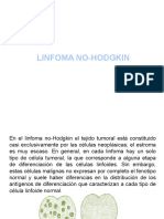 Linfoma No Hodgkin