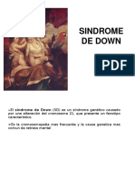 SD: Síndrome de Down