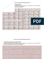 Practica de Electrocardiograma
