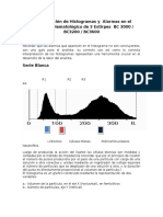 Interpretación de Histogramas