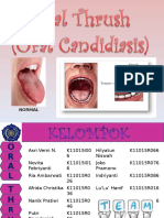 Oral Candidiasis+soal 2003