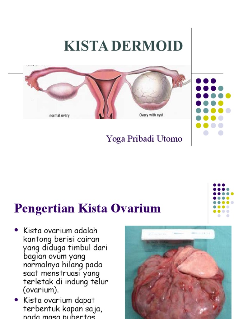 Kanker Otak Pengertian Gejala Penyebab Faktor Risiko