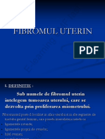 Fibromul Uterin e