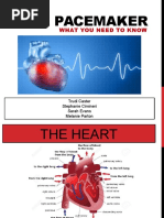 Ultrasonic Scalers and Pacemaker Precautions | PDF | Artificial Cardiac ...