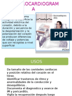 Guía completa sobre electrocardiograma (ECG