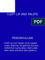 Cleft Lip and Palate