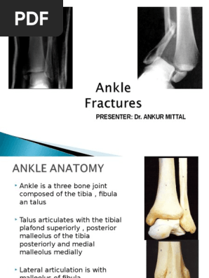Ankle Fracture Ankle Musculoskeletal System Ankle Fracture Ankle Musculoskeletal System