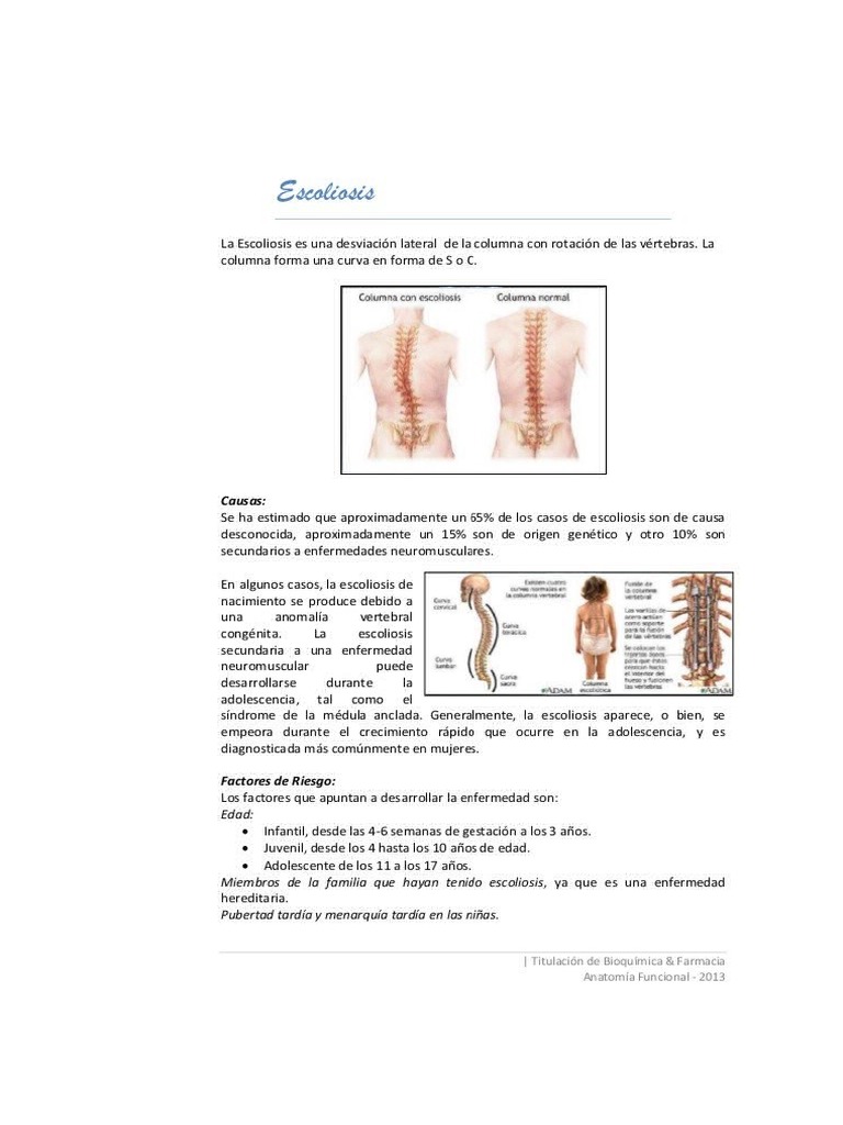 Enfermedades de La Columna Vertebral | PDF | Medicina CLINICA ...