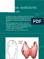 Bocios Nodulares Tóxicos