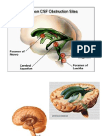 ventriculos diencefallo