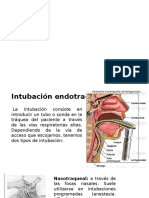Tecnica de Intubacion