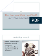 How Does An Artificial Heart Work?: A Closer Look at The Abiocor Implantable Replacement Heart