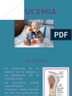 LEUCEMIA