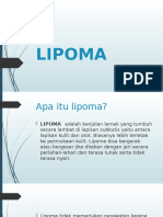 Apa Itu Lipoma Dan Cara Mengobatinya