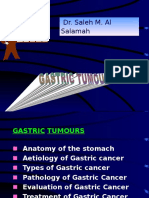 Gastric Tumour