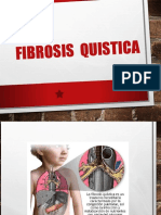 Fibrosis Quistica Fq