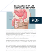 CONOCE LAS CAUSAS POR LAS QUE LA PRÓSTATA SE ENFERMA.docx