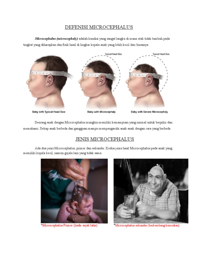 Micro Cep Hal Us | PDF