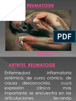02 Artritis Reumatoide