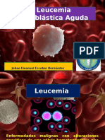 Leucemia Linfoblastica Aguda 3D