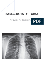 RX de Torax