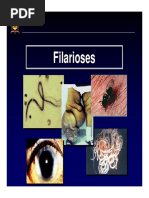 Aula Filarioses Dirofilaria Onchocerca