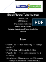 Referat Efusi Pleura TB