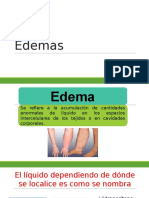 Edemas