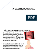 Gastritis