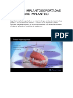 Prótesis Implantosoportadas
