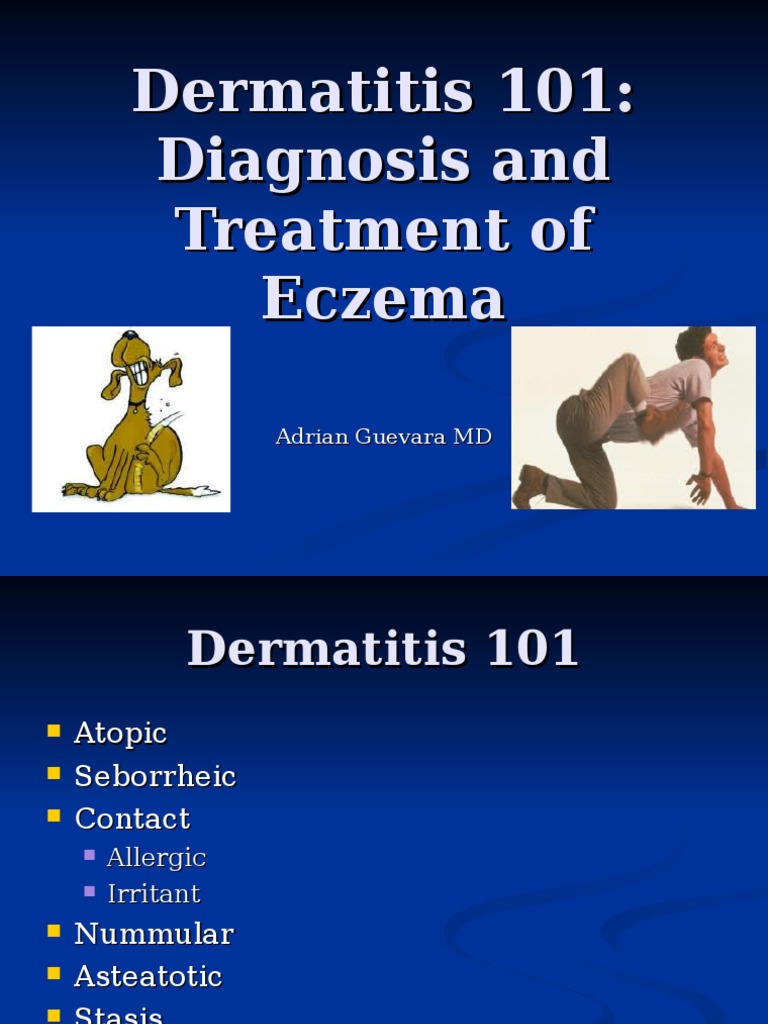Dermatitis101 Diagnosis Treatment Eczema Dermatitis Allergy