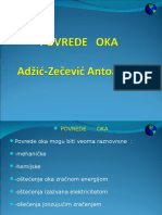 Povrede Oka