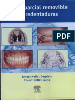 Protesis Parcial y Sobredentadura ERNEST MALLAT Y THOMAS KEOGH