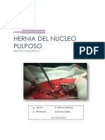 Hernia Del Nucleo Pulposo Informe Cristina Morales