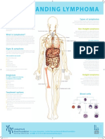 Understanding Lymphoma: The Lymphatic System Types of Lymphoma