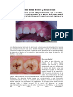 Infecciones de los dientes y de las encías.docx