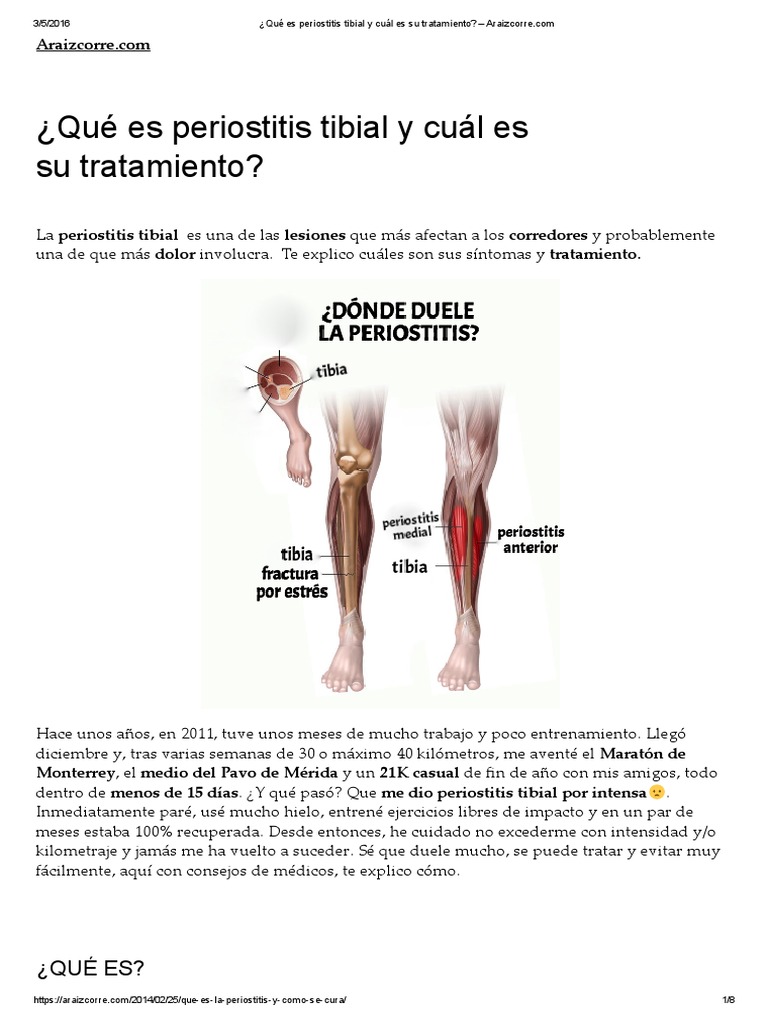 ¿Qué es periostitis tibial y cuál es su tratamiento_ Araizcorre.pdf