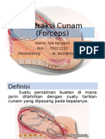 Ekstraksi Cunam (Forceps)