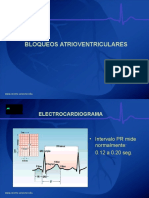 Bloqueos AV - IPN