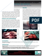 Haemorrhoidectomy With Harmonic Scalpel: Momcilo Stosic, Igor Stojanovic