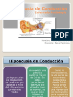 Hipoacusia de Conducción Diapos