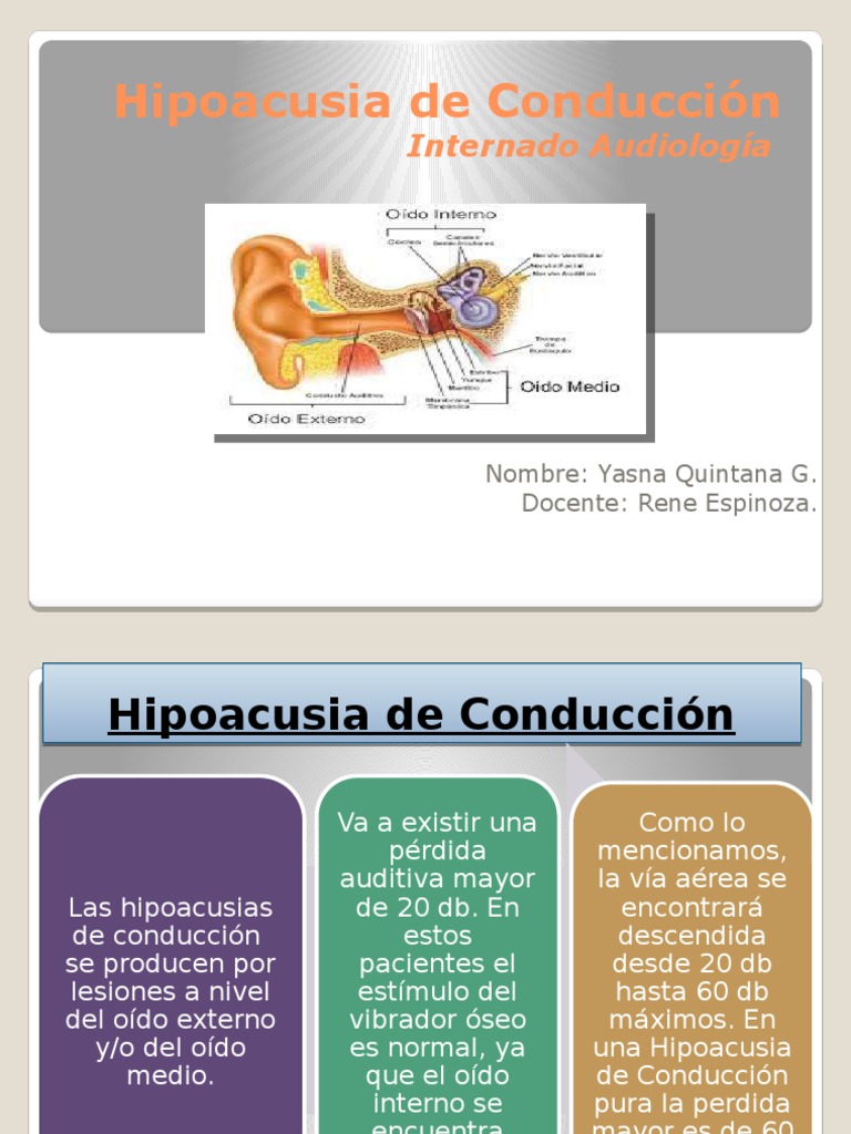 Hipoacusia de Conducción Diapos Oído Enfermedades y trastornos