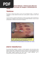 Terapia - Medicina Chinesa - Ventosa para alívio de dores, desintoxicação do sangue e manutenção da saúde..docx